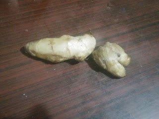 Health Benefits of ginger -  Treatment Of Dandruff