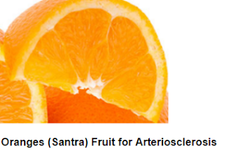 Health Benefits of Oranges (Santra) for Arteriosclerosis Health Benefits of Oranges (Santra) for Arteriosclerosis