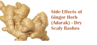 Side Effects of Ginger Herb (Adarak) - Dry Scaly Rashes Side Effects of Ginger Herb (Adarak) - Dry Scaly Rashes