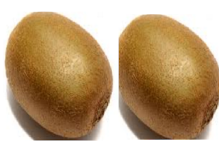 Kiwi Fruit Fights Dandruff and Eczema Kiwi Fruit Fights Dandruff and Eczema