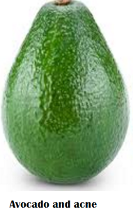 Uses and Benefits of Avocado Seeds or Pits Uses and Benefits of Avocado Seeds or Pits