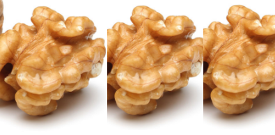 Walnut (Akhrot - Dry Fruits) - Allery Reactions Walnut (Akhrot - Dry Fruits) - Allery Reactions