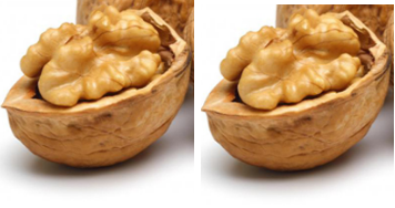 Walnuts (Akhrot - Dry Fruits) - Lip Cancer Walnuts (Akhrot - Dry Fruits) - Lip Cancer