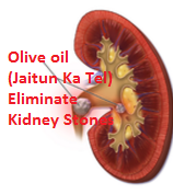 Olive oil (Jaitun Ka Tel) Eliminate Kidney Stones Olive oil (Jaitun Ka Tel) Eliminate Kidney Stones