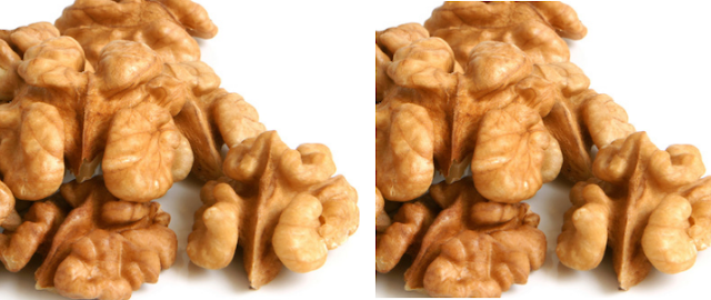 Walnuts (Akhrot - Dry Fruits) - Birth Defects Walnuts (Akhrot - Dry Fruits) - Birth Defects